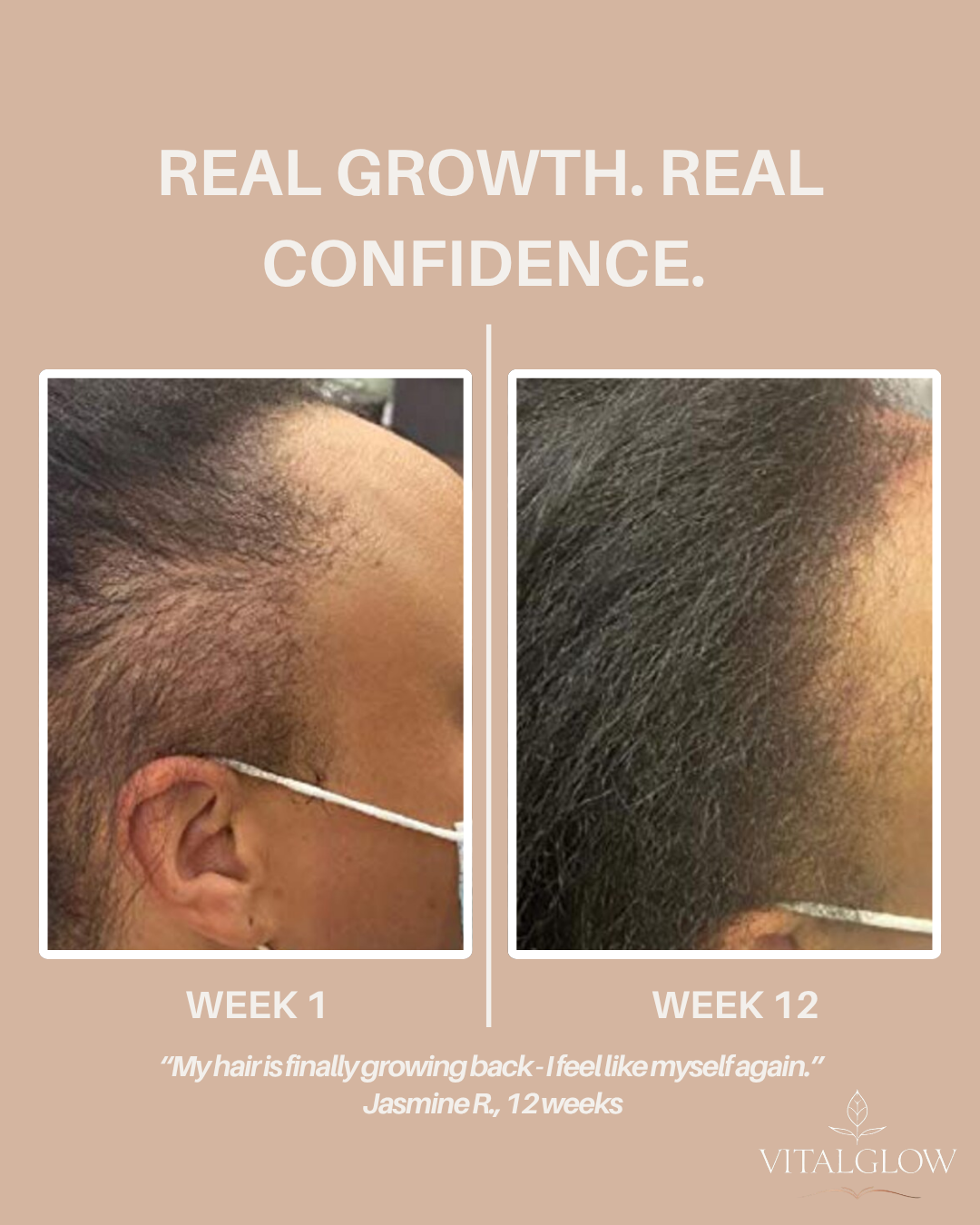 VitalGlow Collagen Peptides